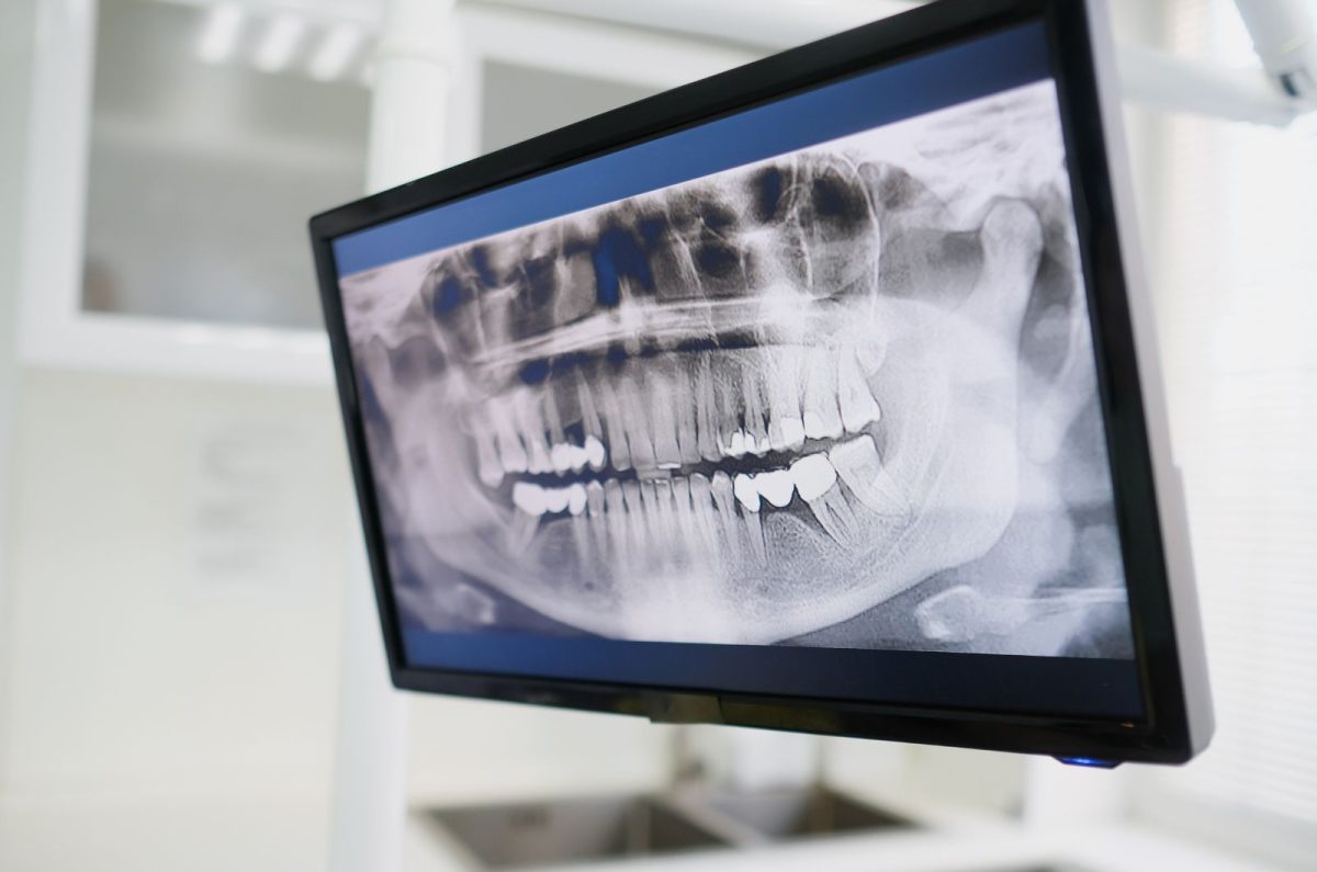 Implant Dentistry Planning